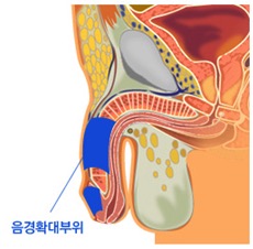 음경확대부위 의료 일러스트